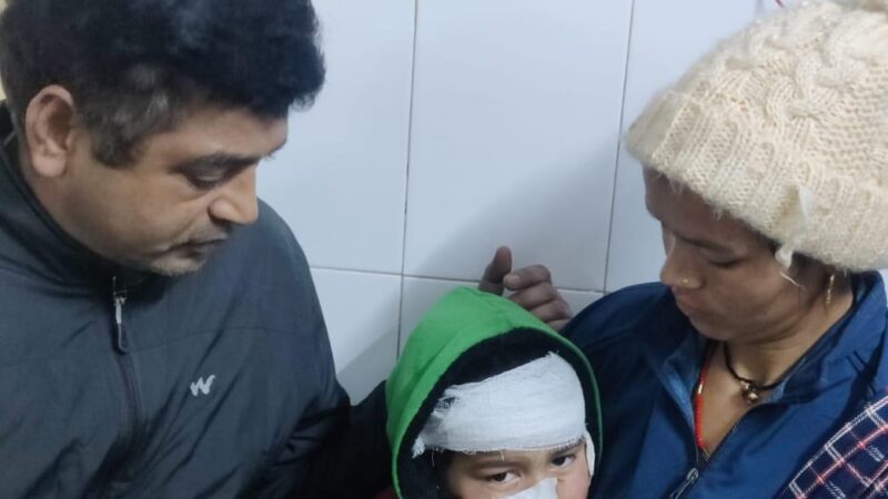 रुद्रप्रयाग : आंगन में खेल रहे बालक पर गुलदार ने किया हमला        